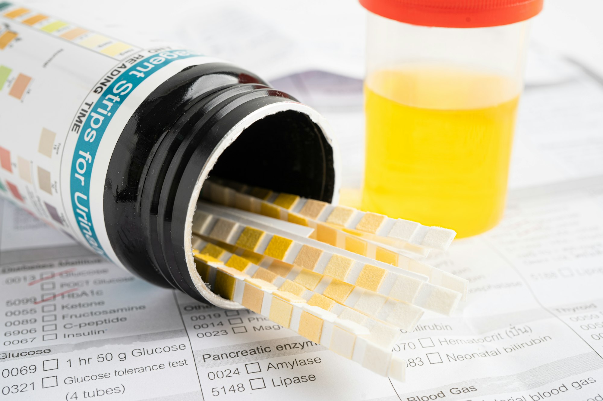 Urinalysis, urine cup with reagent strip pH paper test and comparison chart in laboratory.